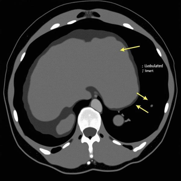 Lobulated Tumor Scan