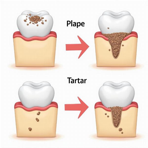 Tartar Formation Process in Hindi